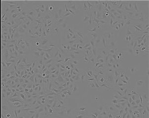 NCI-H292肺**細胞膜復合納米脂質體