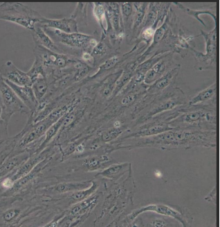 Caki-1腎透明細胞膜**皮膚轉移細胞膜包覆納米粒